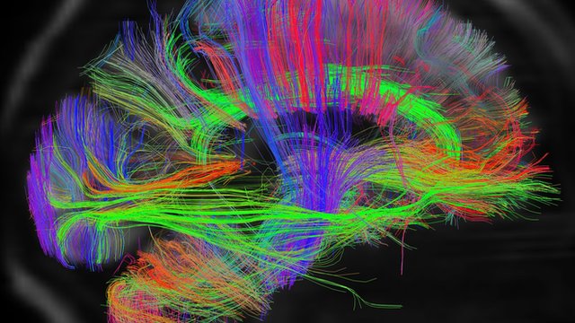 Up close with a human brain - BBC News 